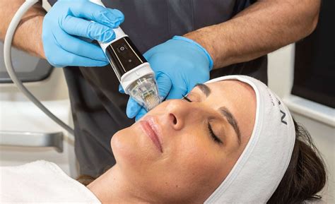 Microneedling Reading | Milan Skin Clinic