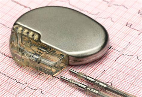 device implant theodore cho md facc