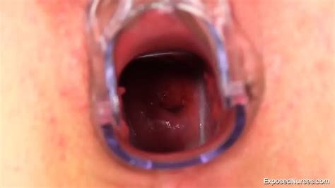 Look At Her Deep Vagina - EPORNER