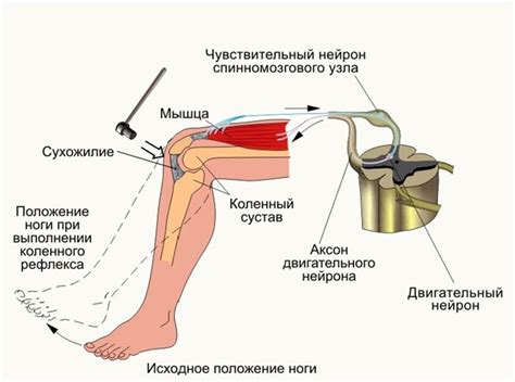 Коленный рефлекс (схема) — Мегаэнциклопедия Кирилла и Мефодия — медиаобъект