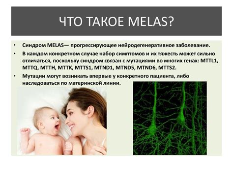 Синдром MELAS - презентация онлайн