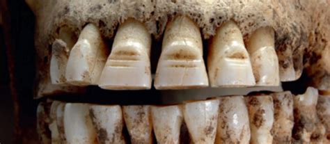 vikings   filed teeth