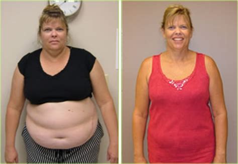 B12 Lipotropic Injections Weight Loss Results - Bios Pics