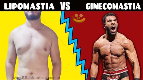 Ginecomastia E Lipomastia - Qual a diferença entre GINECOMASTIA e LIPOMASTIA? Entenda agora! - YouTube