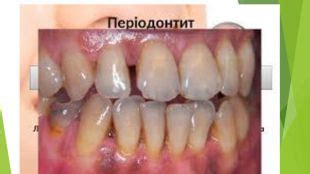 Травлення в ротовій порожнині