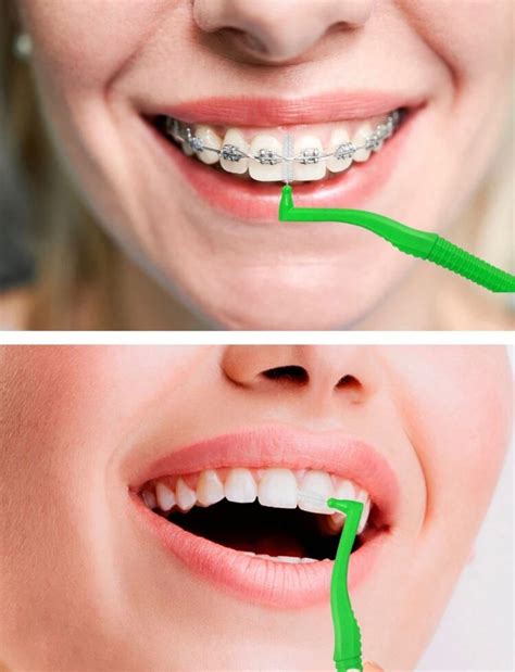 Dr Emma Dental Interdental Brush 10ct | SmokeCircus PR