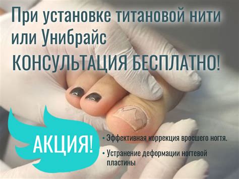 Титановая нить против вросшего ногтя: эффективно и безболезненно ...