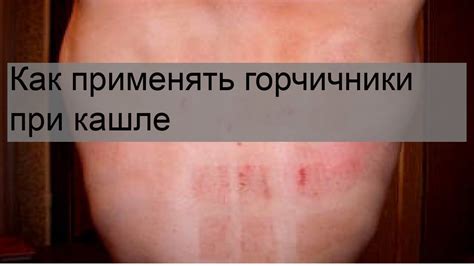 Как применять горчичники при кашле - YouTube