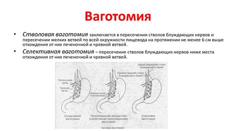 Неонкологические заболевания желудка - online presentation