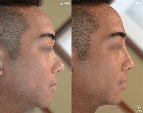 What Traits Are Most Attractive In A Male Nose?