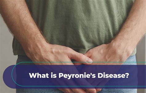 pharma solutions  linkedin   peyronies disease