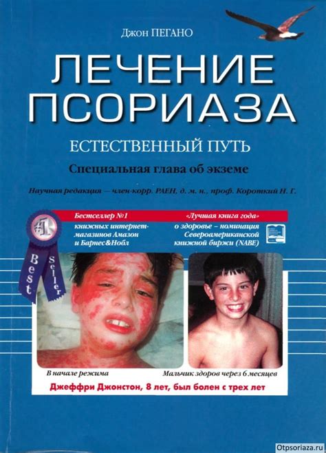 Диета Пегано при псориазе – меню на неделю, таблица и книга