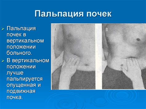 Диагностика и основные синдромы при патологии почек - презентация онлайн