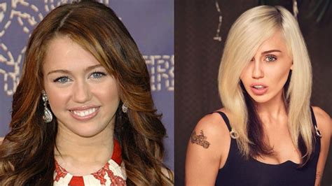 Miley Cyrus' Plastic Surgery: The Singer Looks Different with a New ...