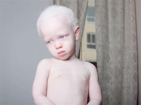 Angelina D'Auguste Eye-Catching portraits that celebrate Albinism ...