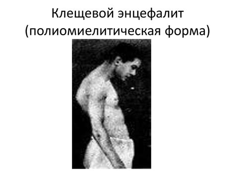 Иксодовый клещ –переносчик вируса клещевого энцефалита - презентация онлайн