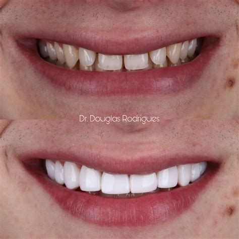 Odontologia Especializada... - Odontologia Especializada