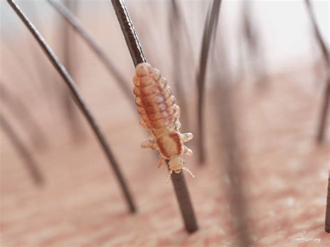 die  lice   reality    myth licedoctors
