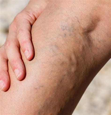 green veins showing through skin - Pregnancy Informations