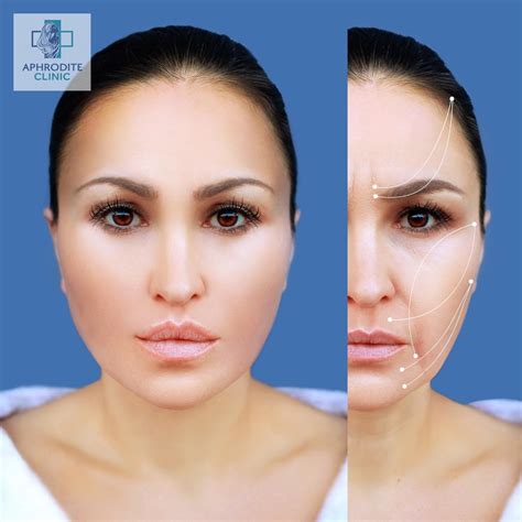 Discover The Benefits Of The Abex Procedure As A Minimally Invasive Alternative To A Traditional Tummy Tuck