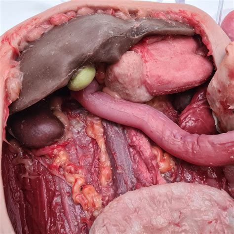 Abdominal Model - MedicFX