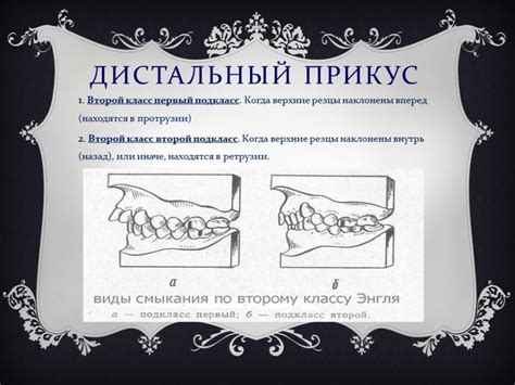 Дистальный прикус - Стоматология Набережные Челны - DENTAL FORTE ...