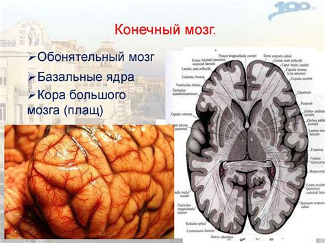 Конечный мозг. Большие полушария. Кора - презентация онлайн