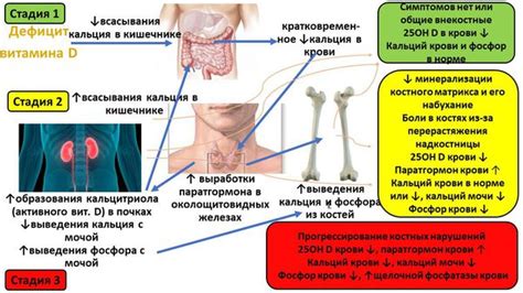Дефицит витамина D: причины, симптомы и лечение в статье эндокринолога ...