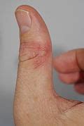 categoryhuman thumbs wikimedia commons