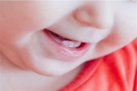 Com Quantos Meses A Gengiva Do Bebe Começa A Coçar - Como fica a gengiva do bebê quando vão nascer os primeiros dentes ...