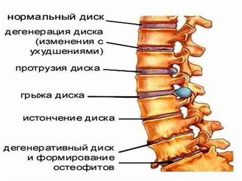 Копчик: анатомия, строение, описание позвонков, функции, заболевания