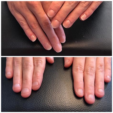 Fingers Throbbing After Gel Nails at Lois Lumpkin blog