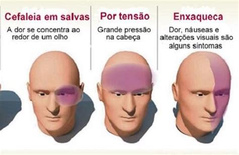 Cefaleia Secundaria A Hipertensão
