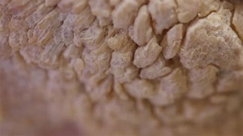 cutaneous horn feet roddlyterrifying