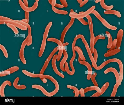 Coloured scanning electron micrograph (SEM) of Vibrio cholerae is a ...