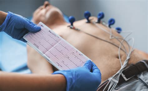 O Eletrocardiograma É Um Exame Cardíaco Que Mede