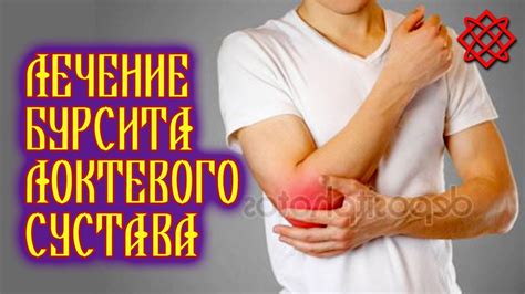 БУPCИТ ЛOКТEВOГO CУCТAВA – CИМПТOМЫ И ЛEЧEНИE. Острая Гнойная ...