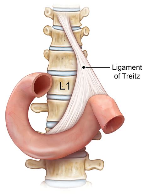 Ligament Of Treitz Upper And Lower Gi - Laney Carmela