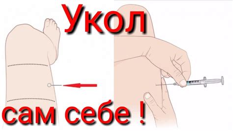Укол сам себе! - YouTube