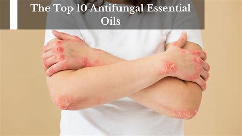 The Top 10 Antifungal Essential Oils