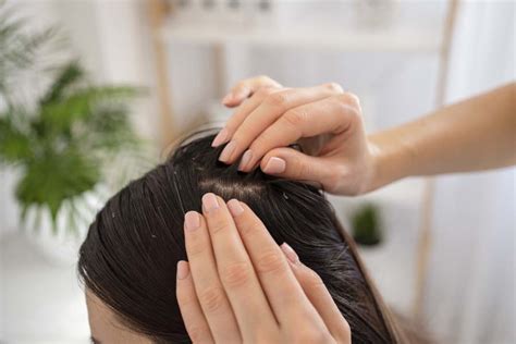 Why Do I Get Pimples On My Scalp? - Klarity Health Library
