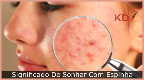 Sonhar Com Espinha: Significado real!