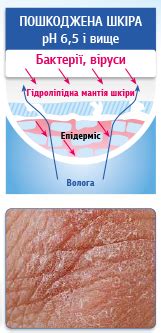 Клобаза. відновлює епідермальний бар'єр
