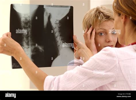 CERVICAL VERTEBRA, X-RAY Stock Photo - Alamy