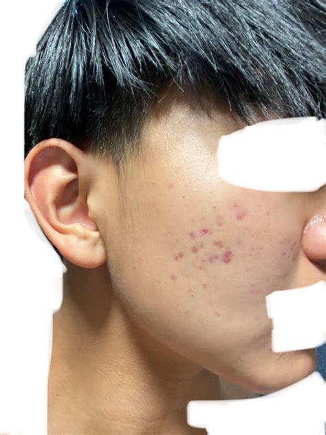 Anyone know how to get rid this? Right side of face is fine as it