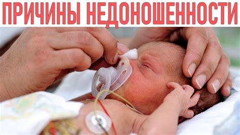 НЕДОНОШЕННЫЙ РЕБЕНОК ПРИЧИНЫ | Есть целых 8 причин почему ваш ребенок ...