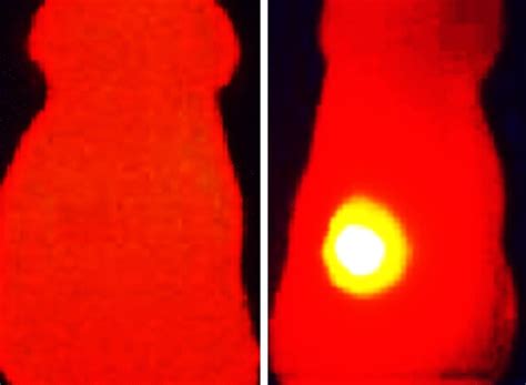 Melanin injections found to highlight and hinder tumors