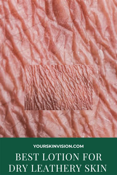 5 Best Lotion For Dry Leathery Skin In 2024 - YourSkinVision