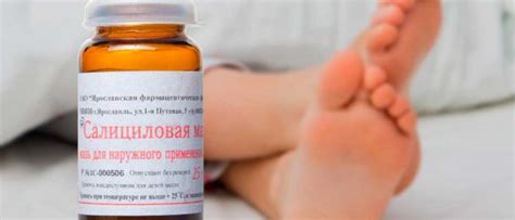 Салициловая кислота от перхоти: как использовать
