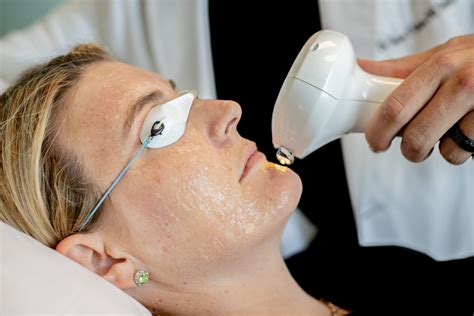 Achieve Your Best Body at Modera Clinic with Morpheus8, Lumecca, and